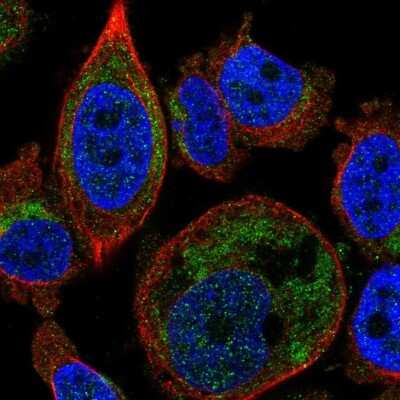 Immunocytochemistry/ Immunofluorescence: GDC Antibody [NBP2-55076]