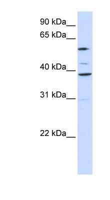 Western Blot: GDC Antibody [NBP1-59588]