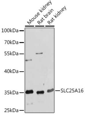 Western Blot: GDC AntibodyAzide and BSA Free [NBP3-15512]