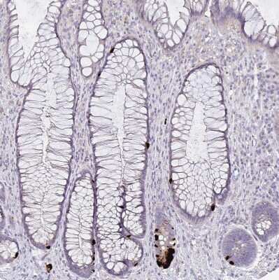 Immunohistochemistry-Paraffin: GDF-15 Antibody (CL0328) [NBP2-52917]