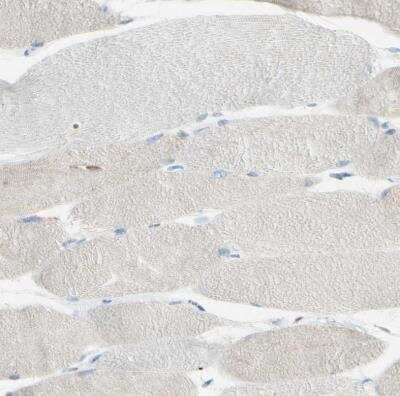 Immunohistochemistry-Paraffin: GDF-15 Antibody [NBP1-81050]