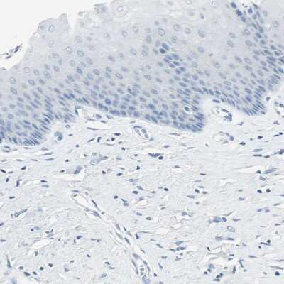 Immunohistochemistry-Paraffin: GDF-15 Antibody [NBP1-81050]