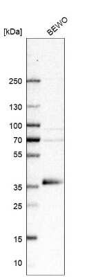 Western Blot: GDF-15 Antibody [NBP1-81050]