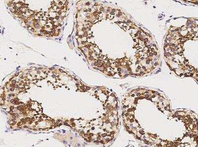 Immunohistochemistry-Paraffin: GDF-3 Antibody (010) [NBP2-89220]