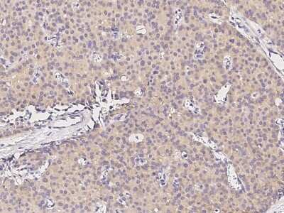 Immunohistochemistry-Paraffin: GDF-3 Antibody (010) [NBP2-89220]