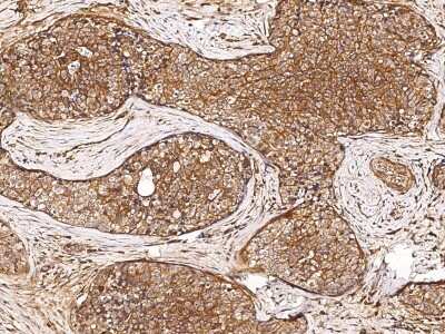 Immunohistochemistry-Paraffin: GDF-3 Antibody [NBP2-98686]