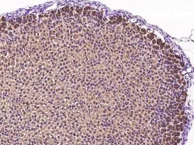 Immunohistochemistry-Paraffin: GDF-3 Antibody [NBP2-99527]