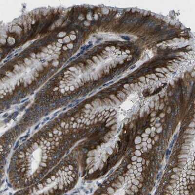 Immunohistochemistry-Paraffin: GDF-5/BMP-14 Antibody [NBP1-88575]