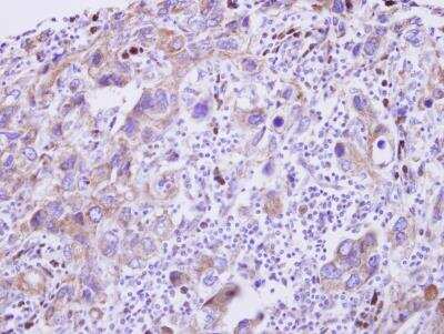Immunohistochemistry-Paraffin: GDF-5/BMP-14 Antibody [NBP2-16632]