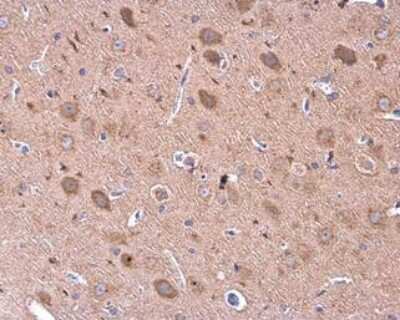 Immunohistochemistry-Paraffin: GDF-6/BMP-13 Antibody [NBP3-13007]