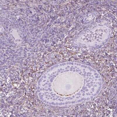 Immunohistochemistry: GDF-9 Antibody [NBP2-49589]