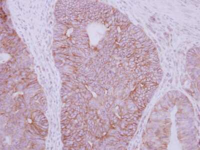Immunohistochemistry-Paraffin: GDF-5/BMP-14 Antibody [NBP2-16631]