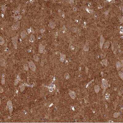 Immunohistochemistry-Paraffin: GDI1 Antibody [NBP2-14041]
