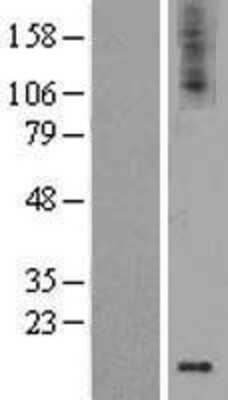 Western Blot: GDNF Overexpression Lysate [NBL1-11032]