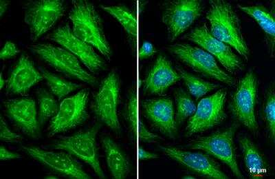 Immunocytochemistry/ Immunofluorescence: GEF-H1 Antibody [NBP2-21577]