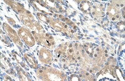 Immunohistochemistry: GEM Antibody [NBP1-58906]