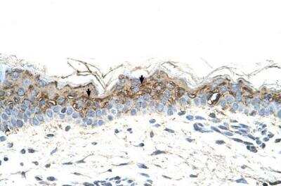 Immunohistochemistry-Paraffin: GEM Antibody [NBP1-58906]