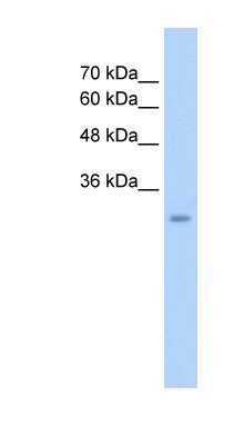 Western Blot: GEM Antibody [NBP1-58906]