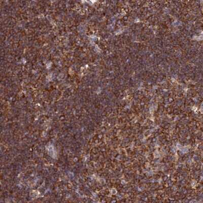 Immunohistochemistry-Paraffin: GEM Interacting Protein Antibody [NBP2-30537]