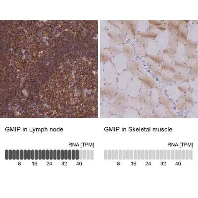 Immunohistochemistry-Paraffin: GEM Interacting Protein Antibody [NBP2-30537]