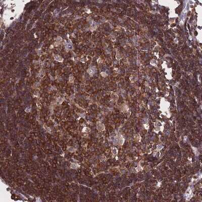 Immunohistochemistry-Paraffin: GEM Interacting Protein Antibody [NBP2-30827]