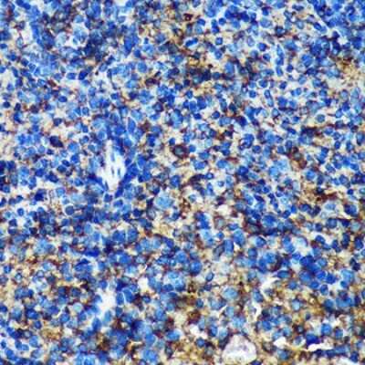 Immunohistochemistry-Paraffin: GEM Interacting Protein Antibody - Azide and BSA Free [NBP3-03540]