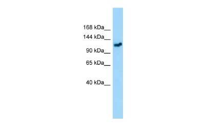 Western Blot: GEM Interacting Protein Antibody [NBP2-84967]