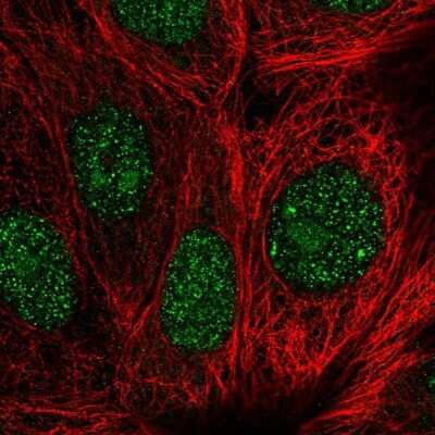 Immunocytochemistry/ Immunofluorescence: GEMIN2 Antibody [NBP2-55393]