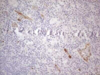 Immunohistochemistry: GEMIN2 Antibody (OTI4C11) - Azide and BSA Free [NBP2-71374]