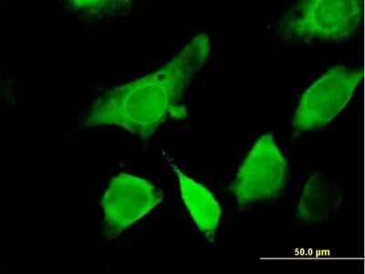 Immunocytochemistry/ Immunofluorescence: GEMIN6 Antibody [H00079833-B01P]