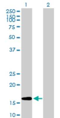 Western Blot: GEMIN6 Antibody [H00079833-B01P]