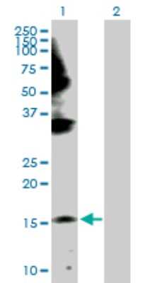 Western Blot: GEMIN6 Antibody [H00079833-D01P]
