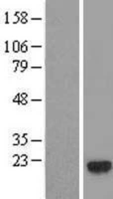 Western Blot: GEMIN6 Overexpression Lysate [NBL1-11038]