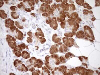 Immunohistochemistry: GEMIN8 Antibody (OTI1E5) [NBP2-45832]