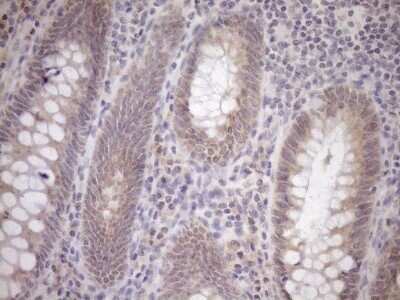 Immunohistochemistry: GEMIN8 Antibody (OTI1E5) - Azide and BSA Free [NBP2-71977]