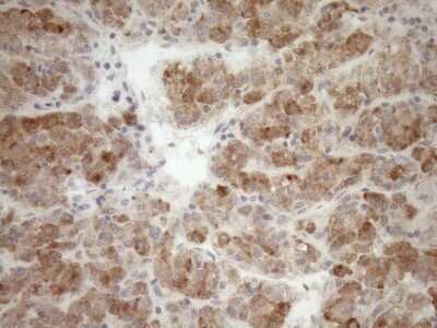 Immunohistochemistry: GEMIN8 Antibody (OTI1E5) - Azide and BSA Free [NBP2-71977]