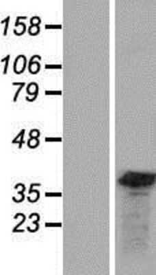 Western Blot: GEMIN8 Overexpression Lysate [NBP2-09232]