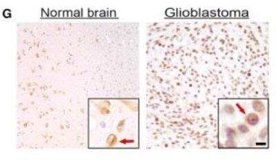 Immunohistochemistry: TRIM8 Antibody [NBP1-89776]
