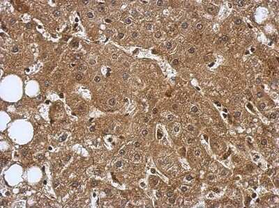 Immunohistochemistry-Paraffin: TRIM8 Antibody [NBP2-16642]