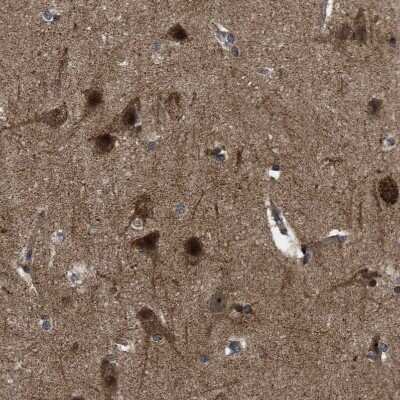 Immunohistochemistry-Paraffin: GET4 Antibody [NBP1-86732]