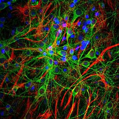 Immunohistochemistry: GFAP Antibody (5C10) [NBP1-05197]