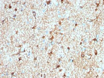Immunohistochemistry-Paraffin: GFAP Antibody (ASTRO/1974R) - Azide and BSA Free [NBP3-08431]