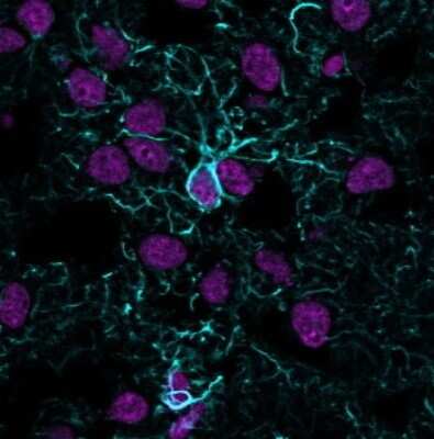 Immunocytochemistry/ Immunofluorescence: GFAP Antibody (ASTRO/1974R) [NBP3-07877]