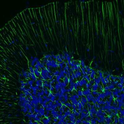 Immunohistochemistry-Paraffin: GFAP Antibody (CL2713) [NBP2-76477]