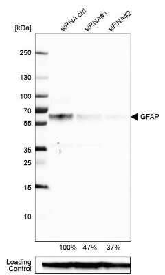 Western Blot: GFAP Antibody (CL2713) [NBP2-76477]