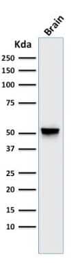 Western Blot: GFAP Antibody (GA-5) [NBP2-29415]