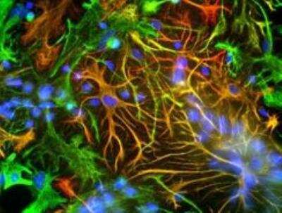 Immunocytochemistry/ Immunofluorescence: GFAP Antibody - Azide and BSA Free [NB110-93480]