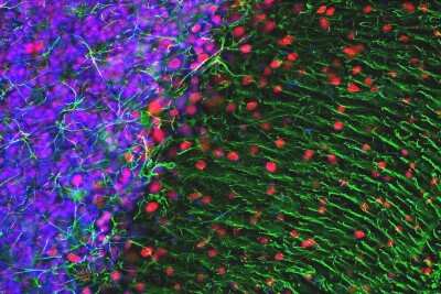Immunocytochemistry/ Immunofluorescence: GFAP Antibody - Azide and BSA Free [NB110-93480]