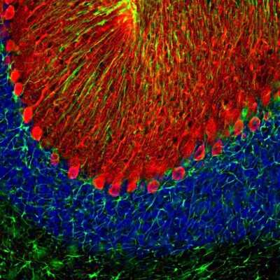 Immunocytochemistry/ Immunofluorescence: GFAP Antibody - Azide and BSA Free [NB110-93480]