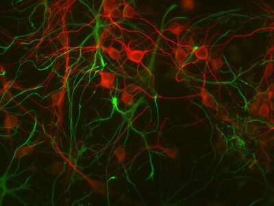 Immunocytochemistry/ Immunofluorescence: GFAP Antibody - Azide and BSA Free [NB110-93480]